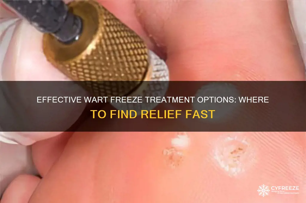 where can i get wart freeze
