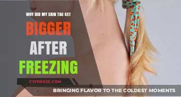 Why Skin Tags Enlarge Post-Freezing: Causes and Solutions Explained