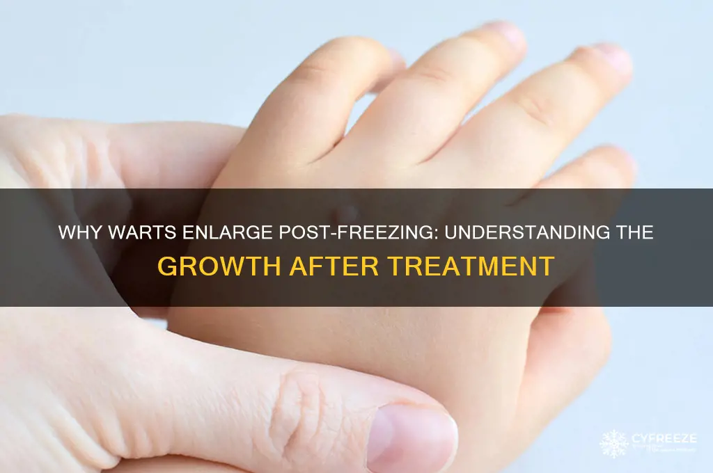 why did my wart get bigger after freezing