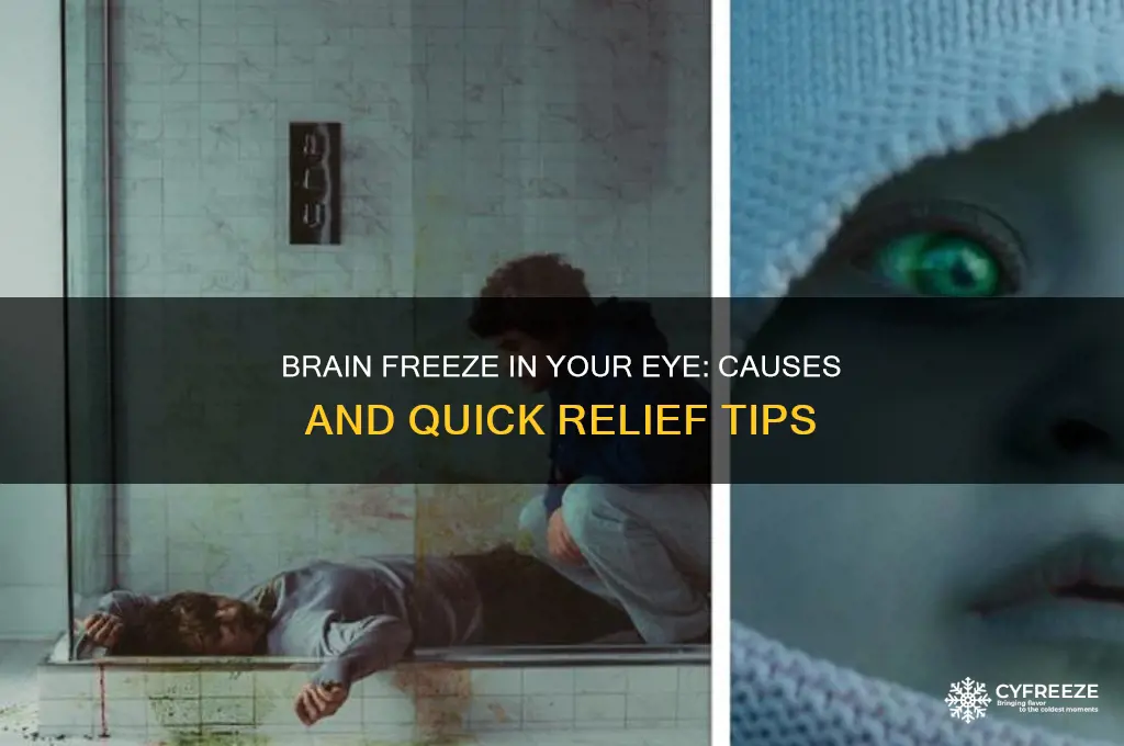 why do i get brain freeze in my eye