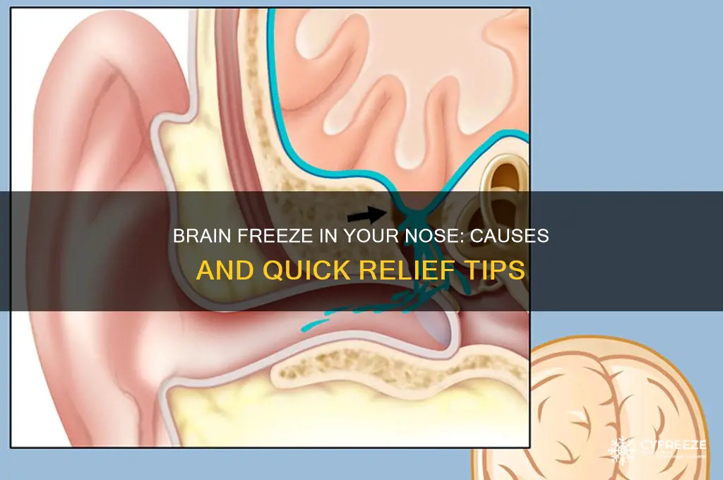 why do i get brain freeze in my nose