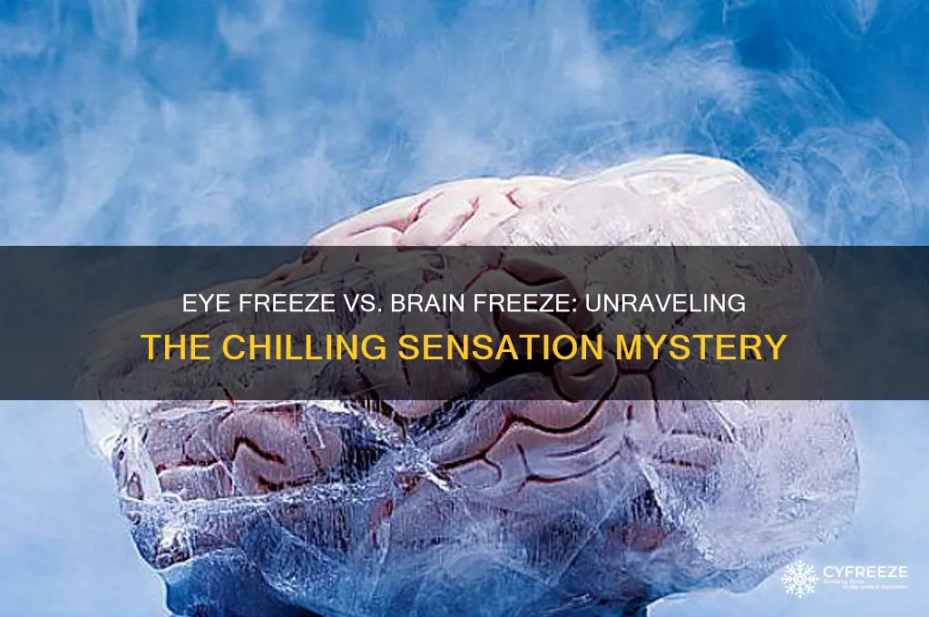 why do i get eye freeze instead of brain freeze