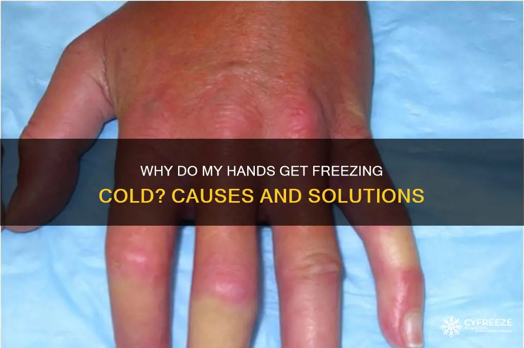 why do my hands get freezing cold