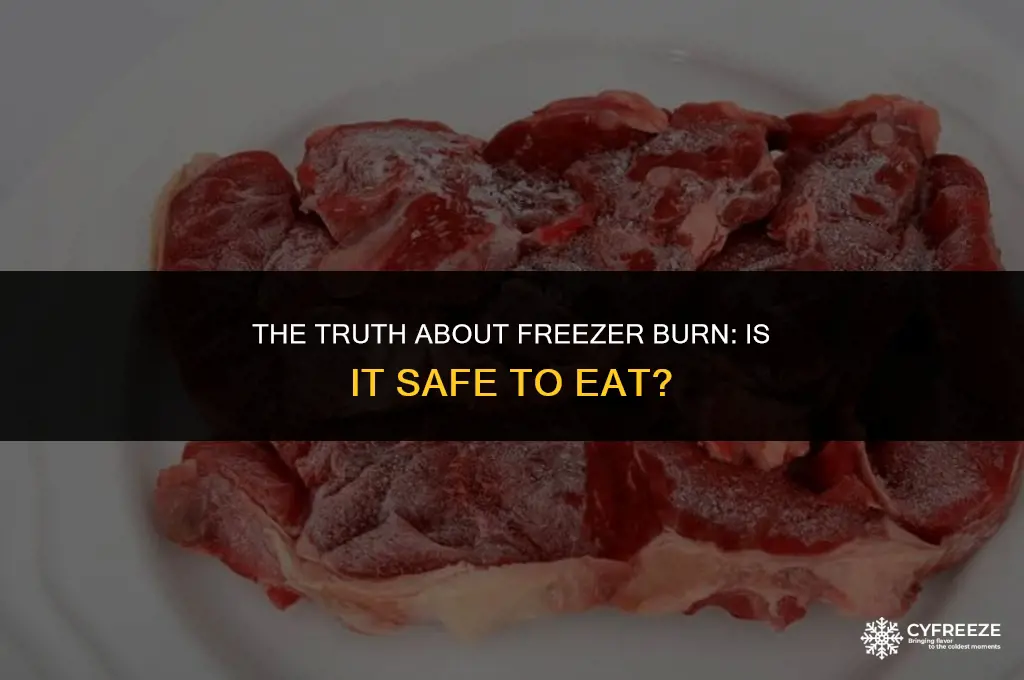 will freezer burn make you sick